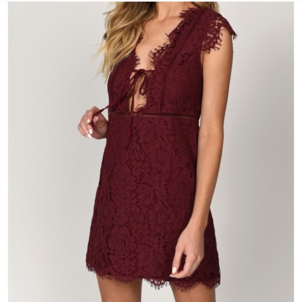 Tobi lace dress